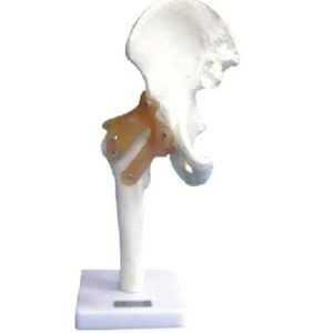 11209-4 Hip Joint with Ligament Model